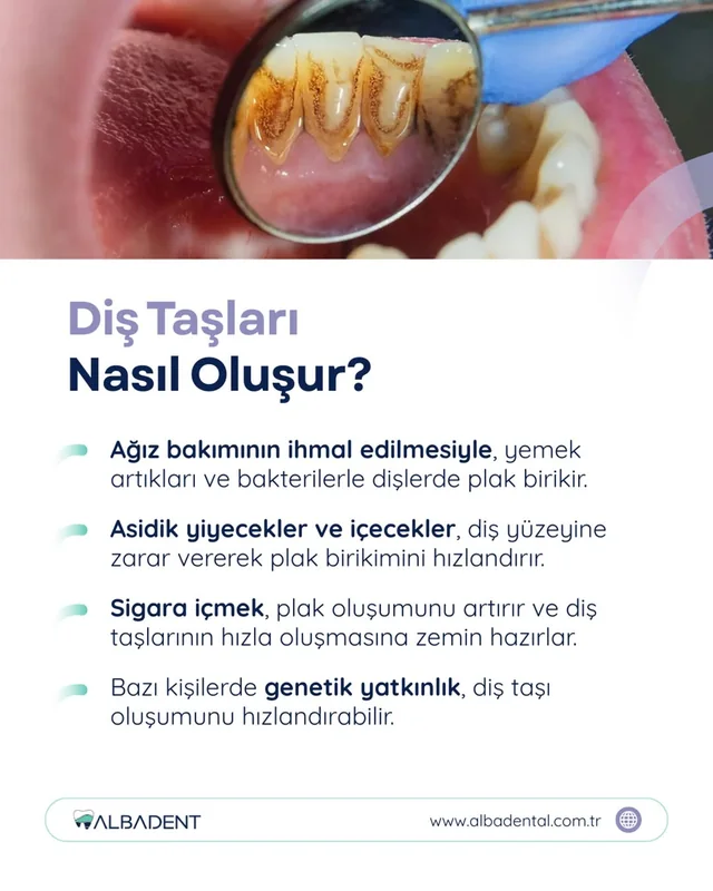 Albadent Diş Kliniği çalışma örneği 2