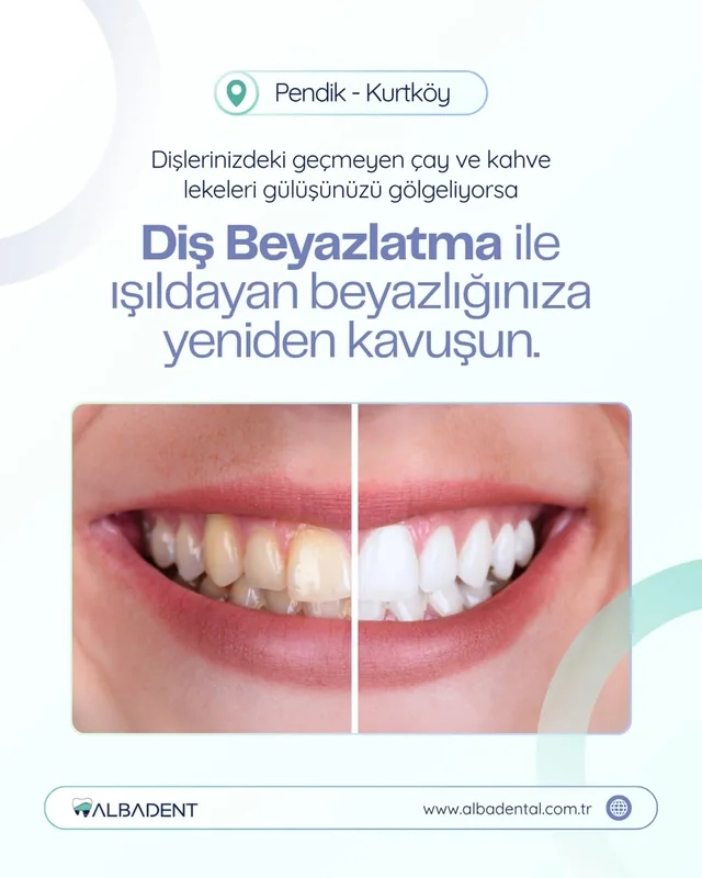 Albadent Diş Kliniği çalışma örneği 4