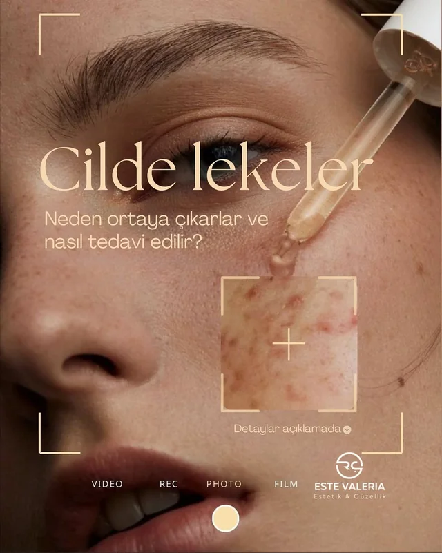 Este Valeria Güzellik Salonu çalışma örneği 4