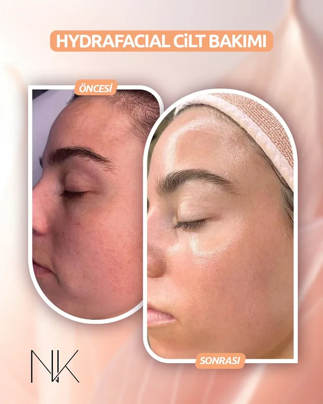Nezaket Keskin Güzellik Merkezi çalışma örneği 4